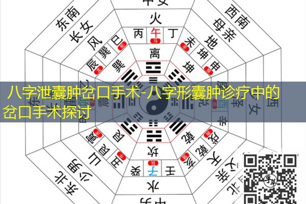  八字泄囊肿岔口手术-八字形囊肿诊疗中的岔口手术探讨